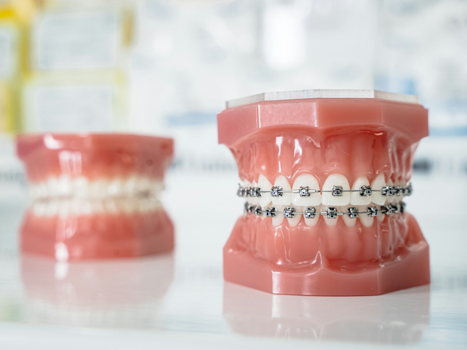 Orthodontie à Neuchâtel - Opale Dental